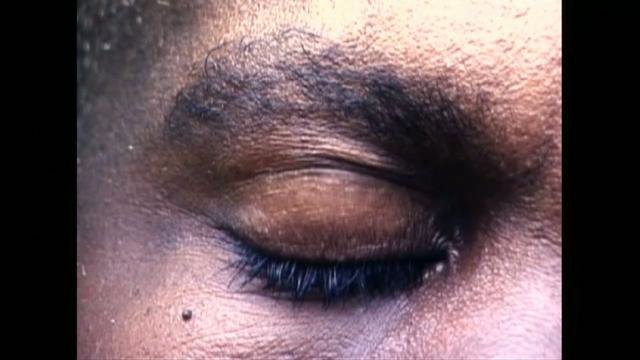 Eye